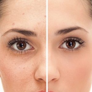 Soins du visage Payot - Pureté