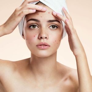 Soin du visage ado