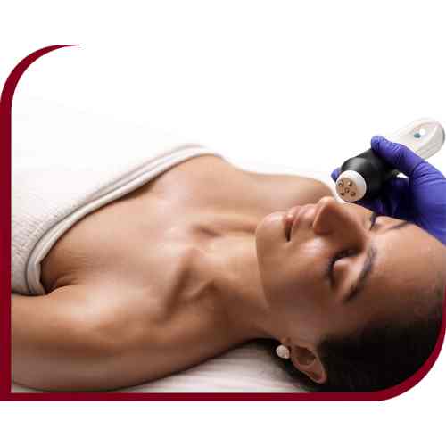 radiofrequency delson south Shore mtl